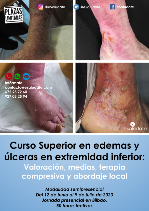 2023_-_Edemas_-_Bilbao-esaludate
